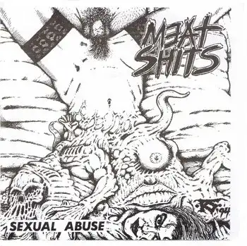 Sexual Abuse