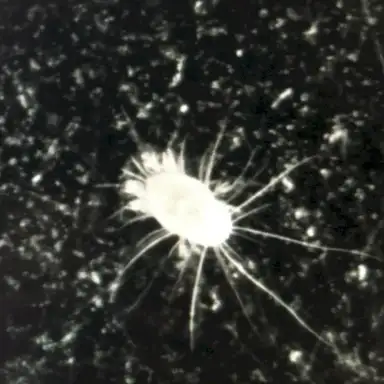 Dustmite EP