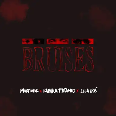 Bruises