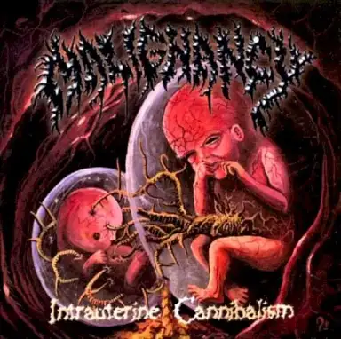 Intrauterine Cannibalism