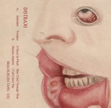 Distraxi