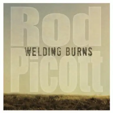 Welding Burns
