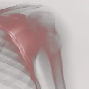 Incomplete Fracture