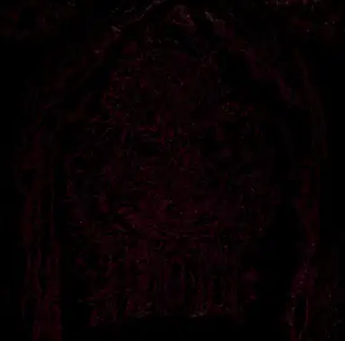 Blight Upon Martyred Sentience