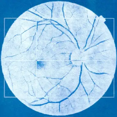 Tresor