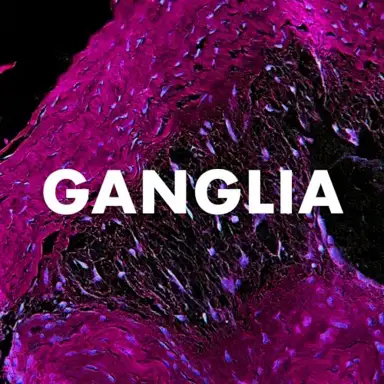 Ganglia