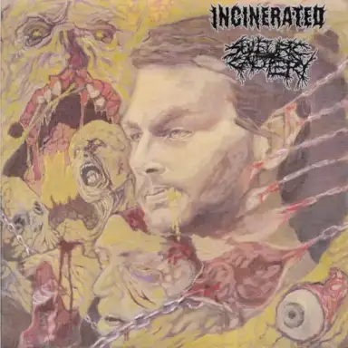Incinerated / Sulfuric Cautery