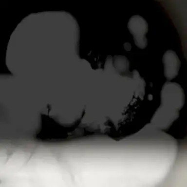Apophenia