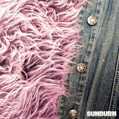 Sunburn