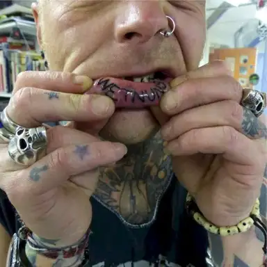 Broken Teeth